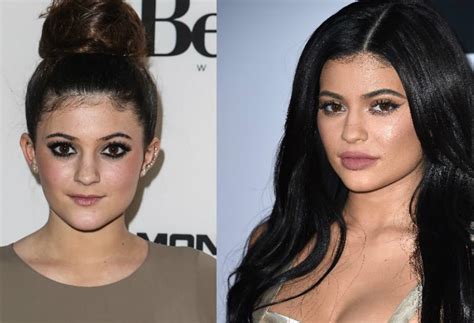 Top 10 celebrities with the best plastic surgery